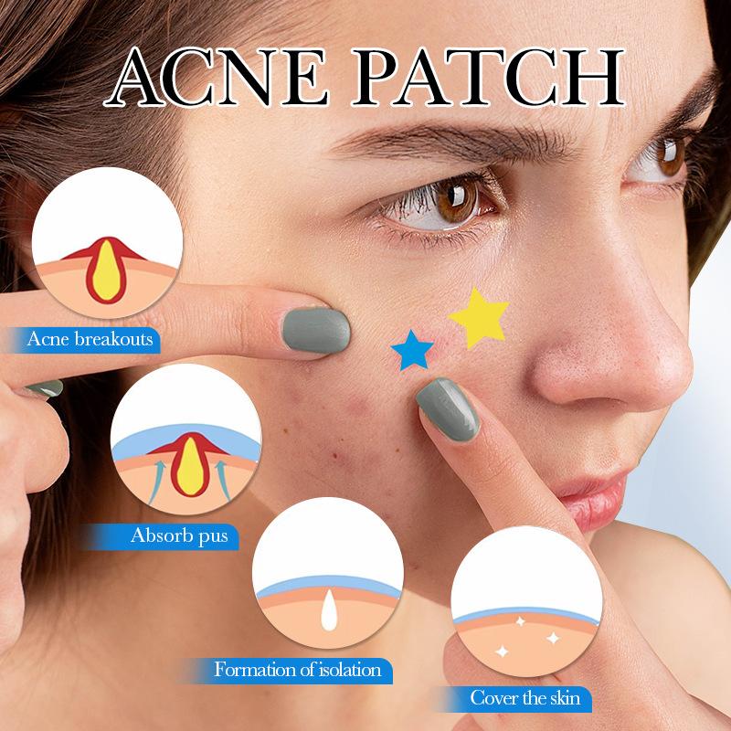 Pimple Patches  - 78 pack